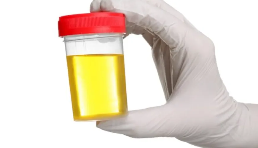 How to Avoid Urinary Tract Infections and Bacteria in Urine?