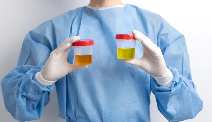 Green urine and other changes that should concern you