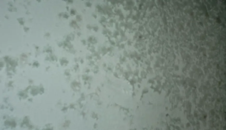 Effective Methods to Combat Mold on Walls