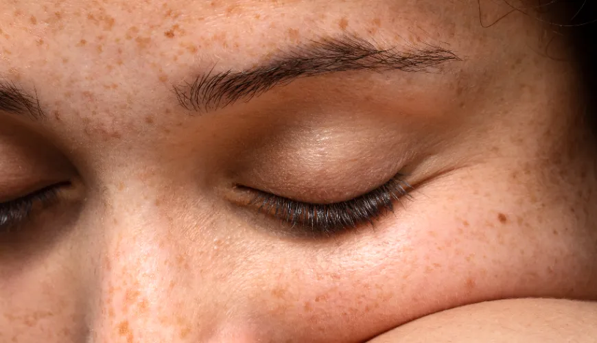 Why Do Brown Spots Appear on the Skin and How to Prevent Them?