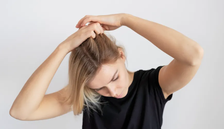 Try Home Remedies for Dandruff That Really Help